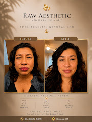 Raw Aesthetic Medical Spa by Sally Aziz logo
