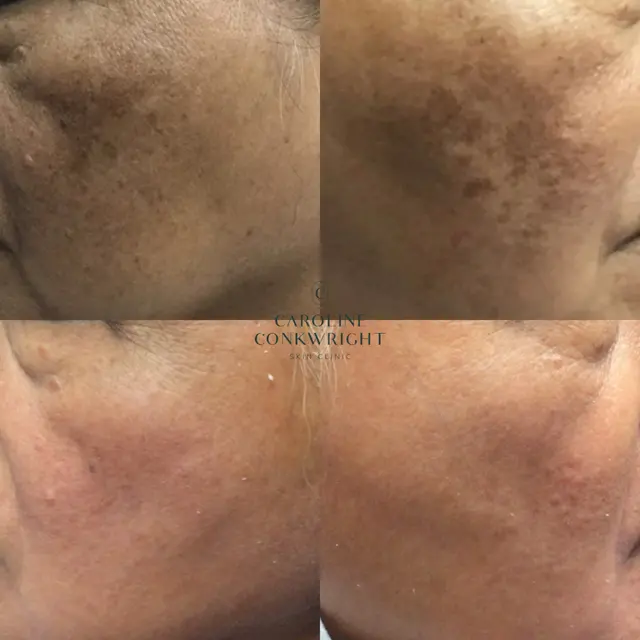 Caroline Conkwright Skin Clinic — photo from the business 11