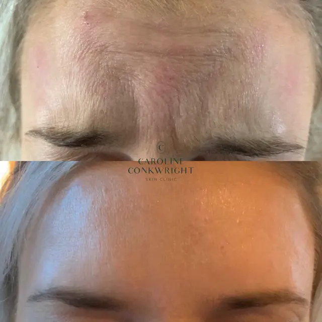 Caroline Conkwright Skin Clinic — photo from the business 7