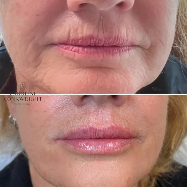 Caroline Conkwright Skin Clinic — photo from the business 6