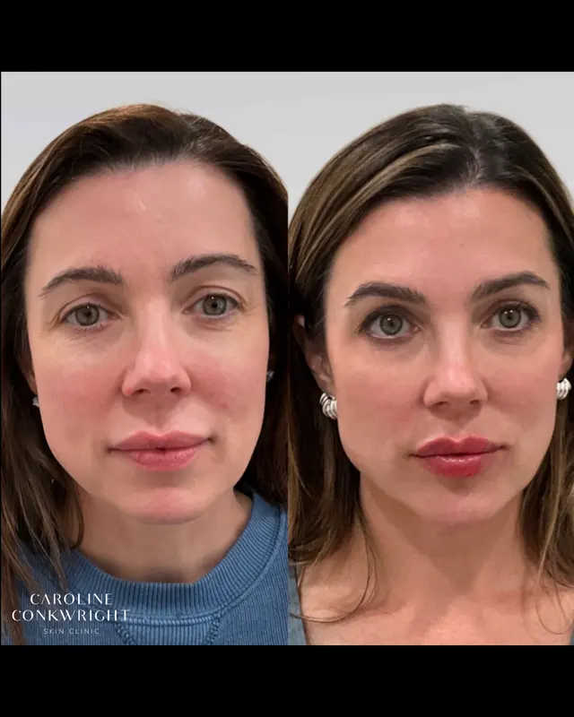 Caroline Conkwright Skin Clinic — photo from the business 12