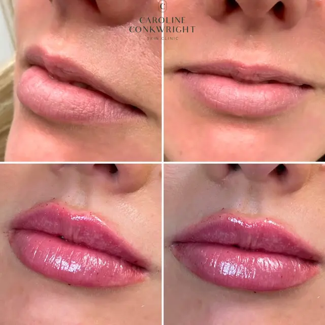 Caroline Conkwright Skin Clinic — photo from the business 3