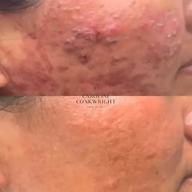 Caroline Conkwright Skin Clinic — photo from the business 10