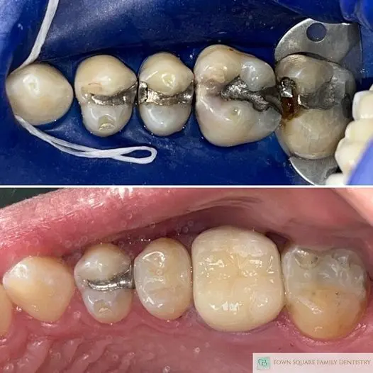 Town Square Family Dentistry — photo from the business 6