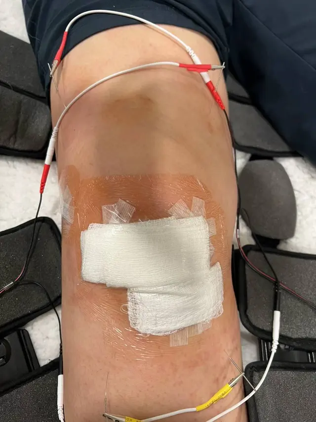 Pain Control & Sports Medicine, Acupuncture Clinic - Dr. Ava Zhang — photo from the business 9