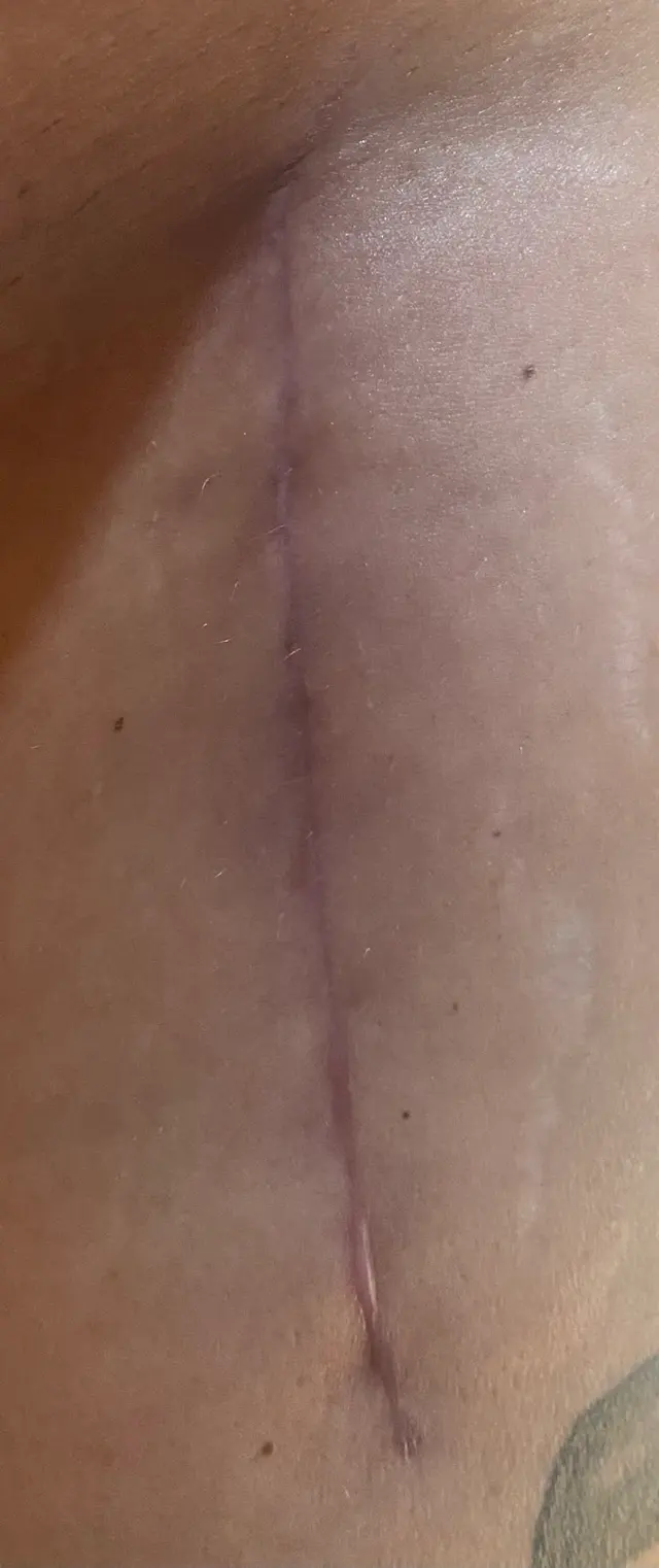 Dr. Anthony M. Bevilacqua, DO — customer photo 11