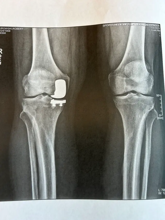 Dr. Anthony M. Bevilacqua, DO — customer photo 10