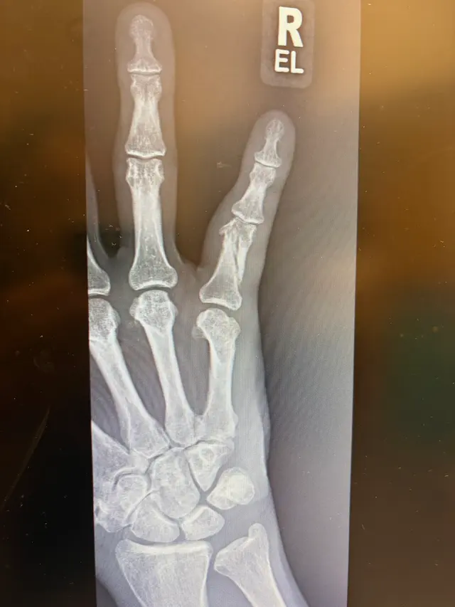 Sports Medicine and Orthopaedic Center & The Spine Center (SMOC) — customer photo 10