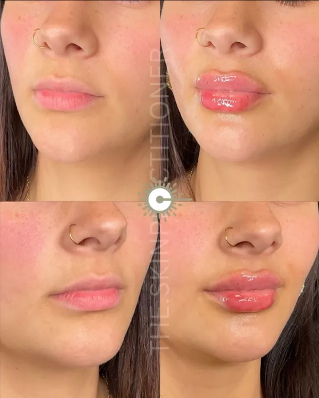 Customer photo from Veronica's review