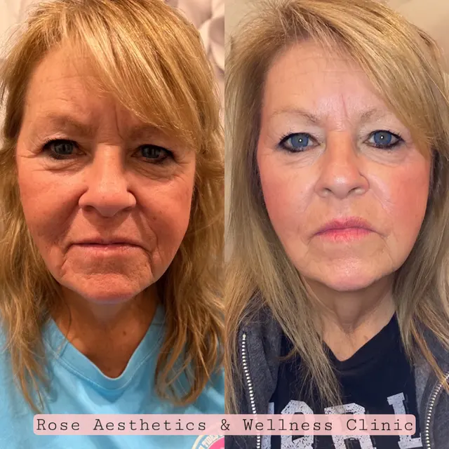 Rose Aesthetics & Wellness Clinic — photo from the business 12