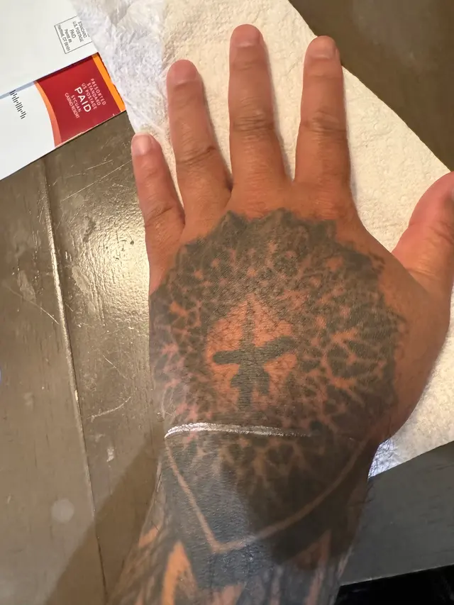 Customer photo of work by Removery Tattoo Removal & Fading, from Hean So's review