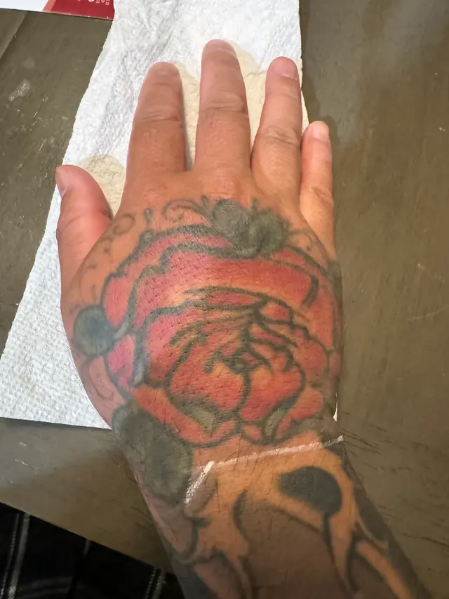 Removery Tattoo Removal & Fading — customer photo 12