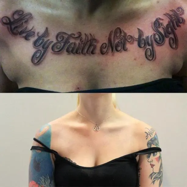 Removery Tattoo Removal & Fading — photo from the business 10