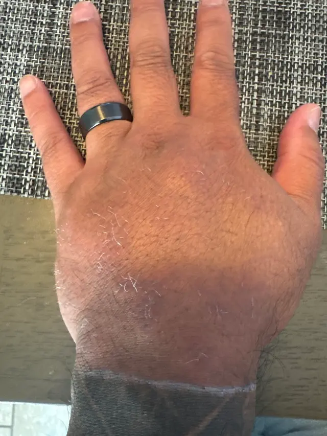 Customer photo of work by Removery Tattoo Removal & Fading, from Hean So's review