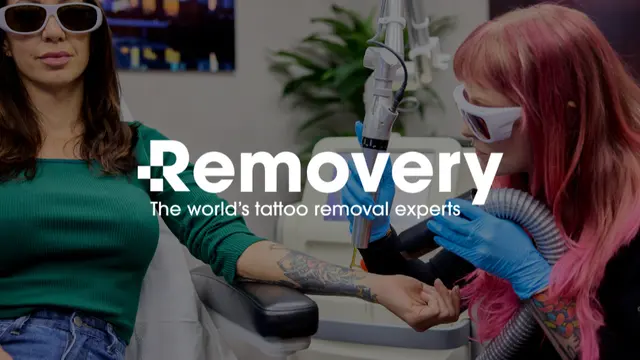 Removery Tattoo Removal & Fading — photo from the business 1