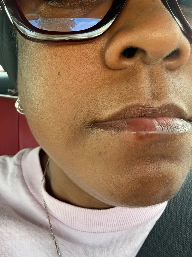 Kansas City Skin & Cancer Center — customer photo 5