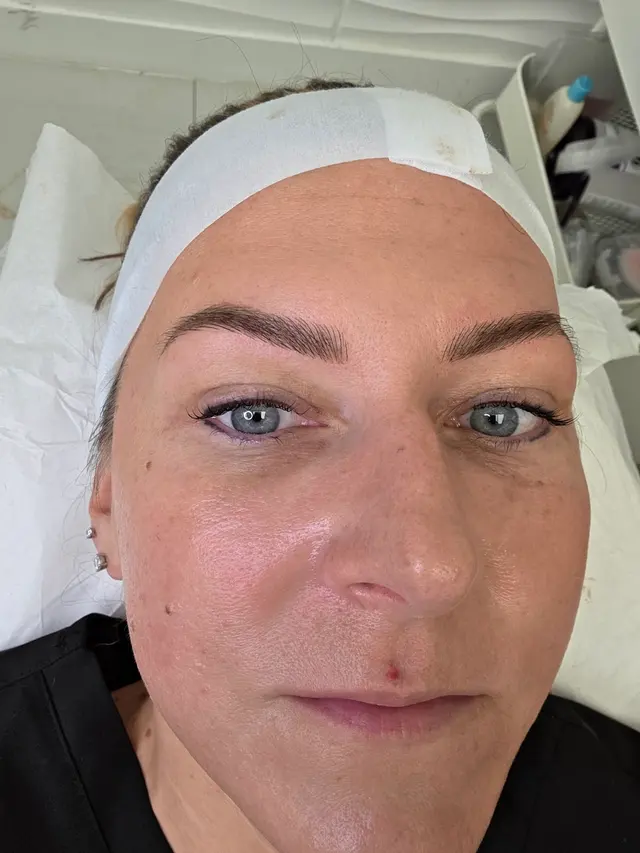 Customer photo of work by Illumine Aesthetic & Beauty Studio - Eyebrows, Lips, PMU, lashes, Anti-aging Treatments, Scalp, Facials, from Shannon Davis's review