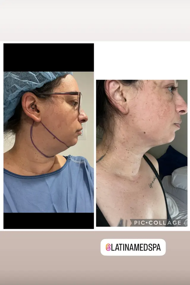 Customer photo from Samantha's review