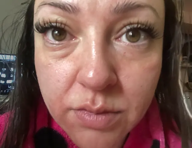Seamless Skin M.D. — customer photo 12