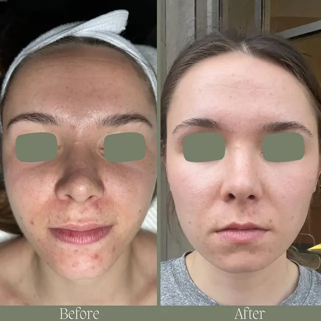 Bliss Med Spa — photo from the business 8