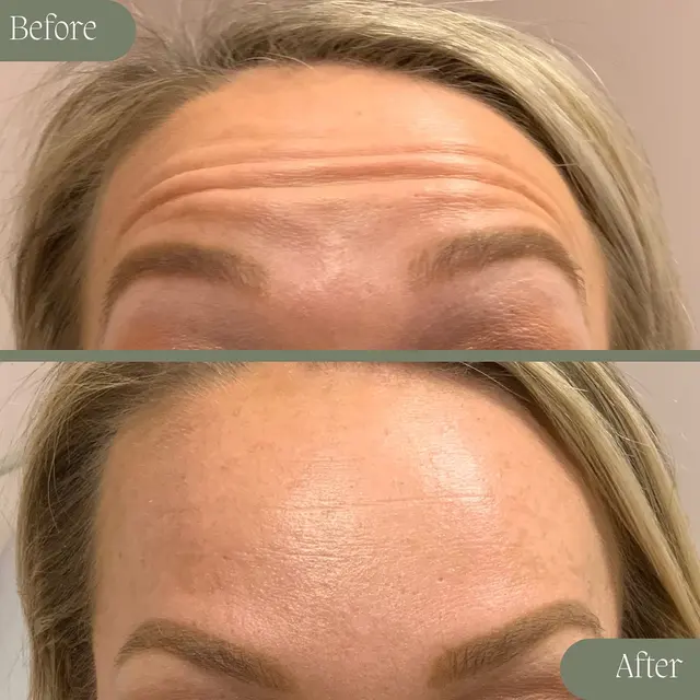 Bliss Med Spa — photo from the business 9