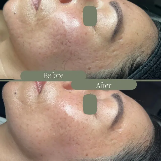 Bliss Med Spa — photo from the business 12