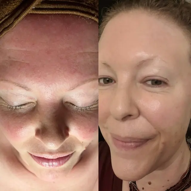 Skin Reset Studio — photo from the business 11