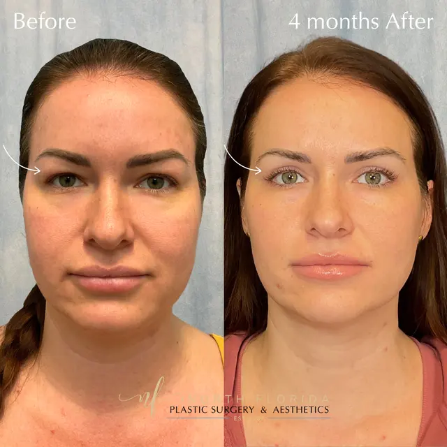 John W. Tyrone, MD, PLLC, Plastic Surgery — photo from the business 12