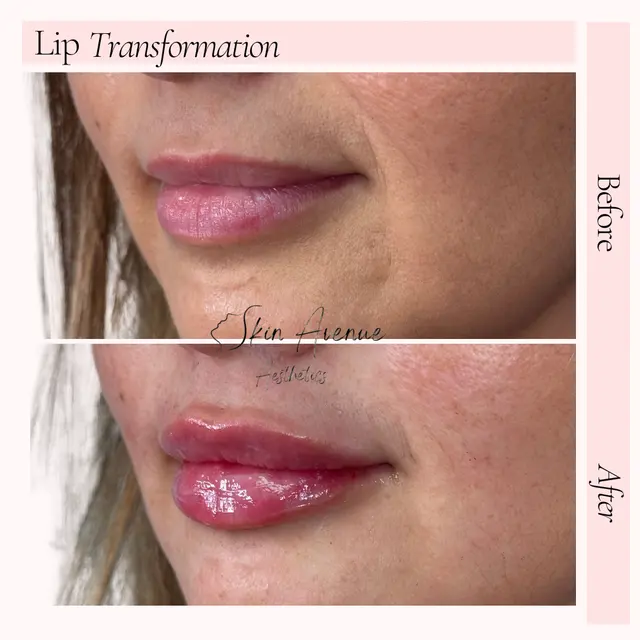 Skin Avenue Aesthetics — photo from the business 6