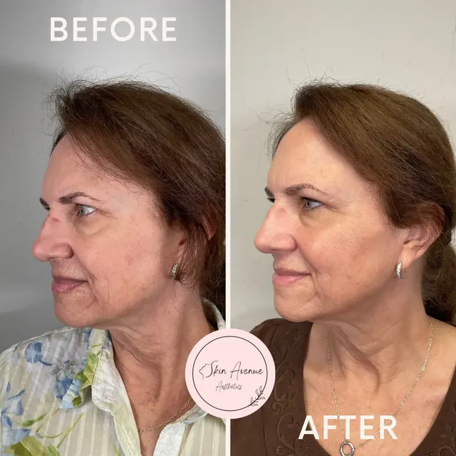 Skin Avenue Aesthetics — photo from the business 12