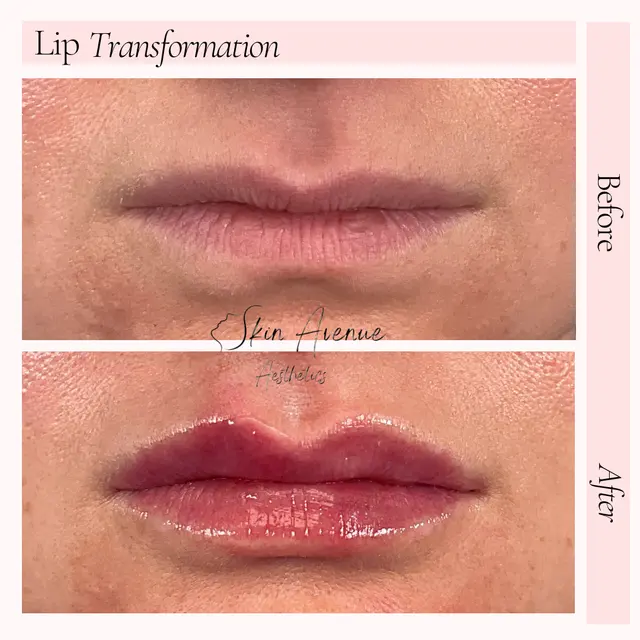 Skin Avenue Aesthetics — photo from the business 11