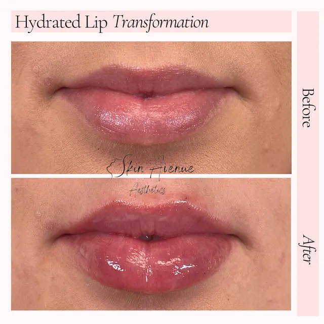 Skin Avenue Aesthetics — photo from the business 8