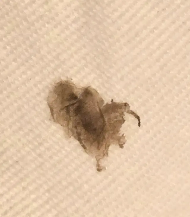 Elite Bed Bug Exterminators Seattle Washington — customer photo 4