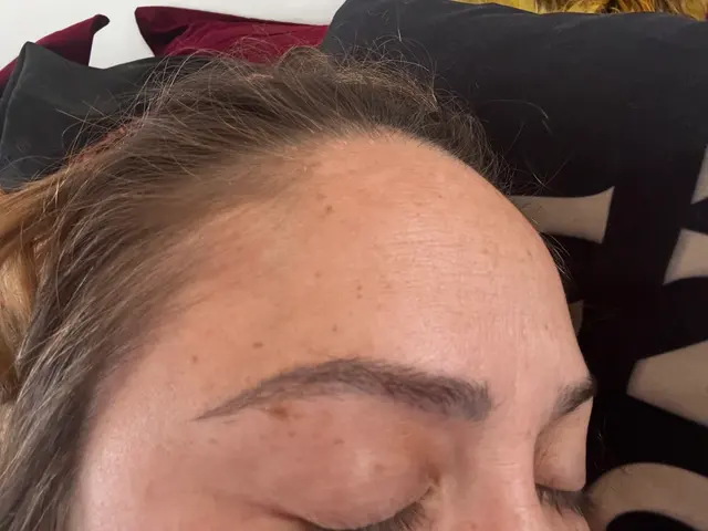 Removery Tattoo Removal & Fading — customer photo 12