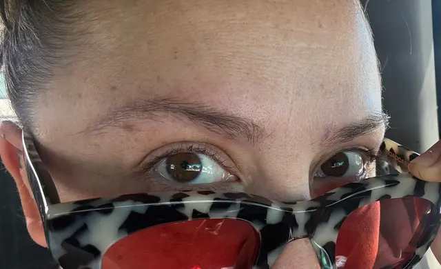 Removery Tattoo Removal & Fading — customer photo 11