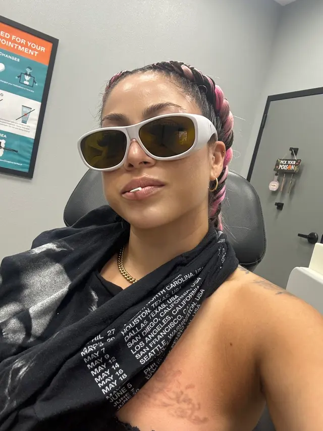 Removery Tattoo Removal & Fading — customer photo 10