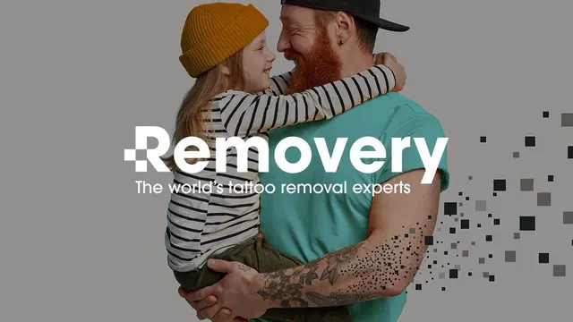 Removery Tattoo Removal & Fading — photo from the business 7