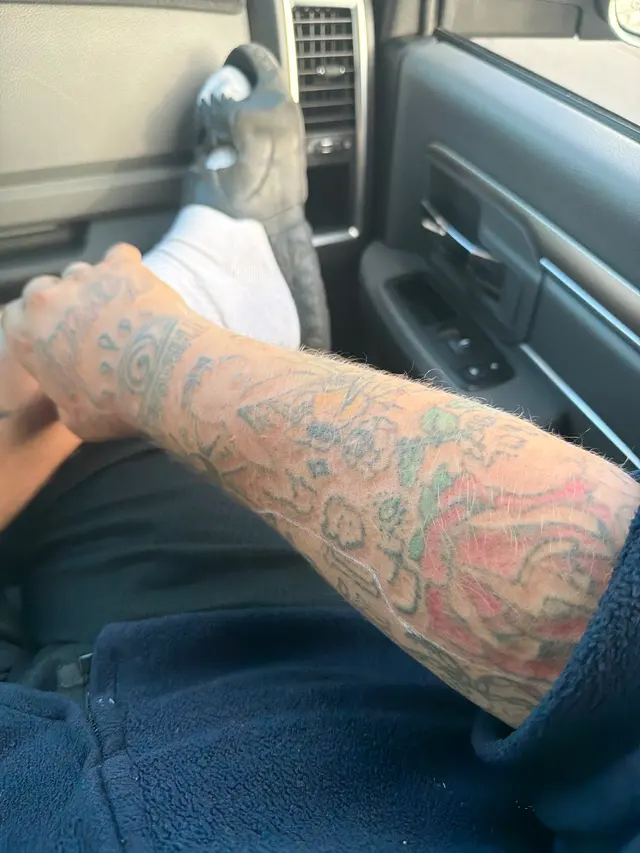 Removery Tattoo Removal & Fading — customer photo 12