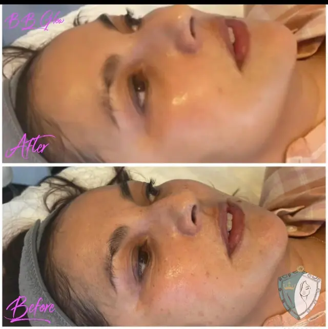 Mediavilla Aesthetics - KM Skin Studio — photo from the business 11