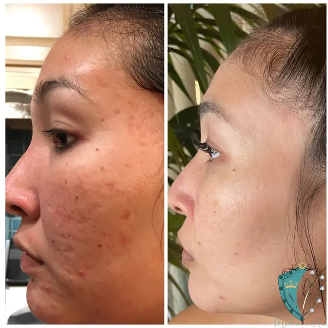 Mediavilla Aesthetics - KM Skin Studio — photo from the business 7