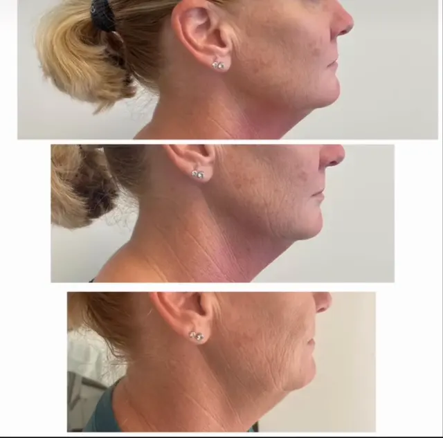 Mediavilla Aesthetics - KM Skin Studio — photo from the business 6