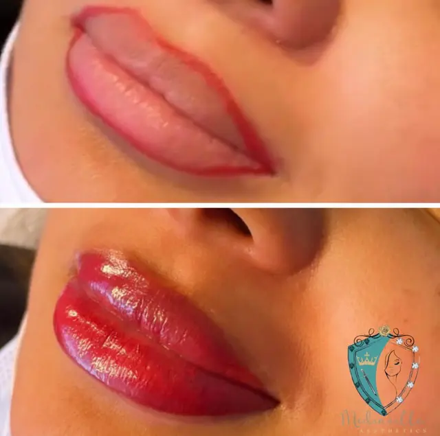 Mediavilla Aesthetics - KM Skin Studio — photo from the business 4