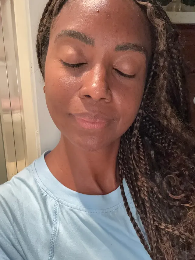 Customer photo of work by Mediavilla Aesthetics - KM Skin Studio, from Antoinette Wright's review