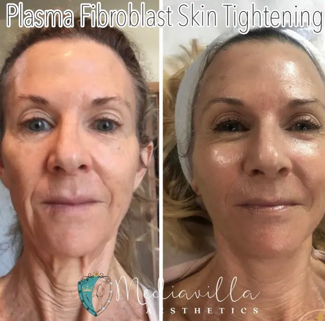 Mediavilla Aesthetics - KM Skin Studio — photo from the business 8