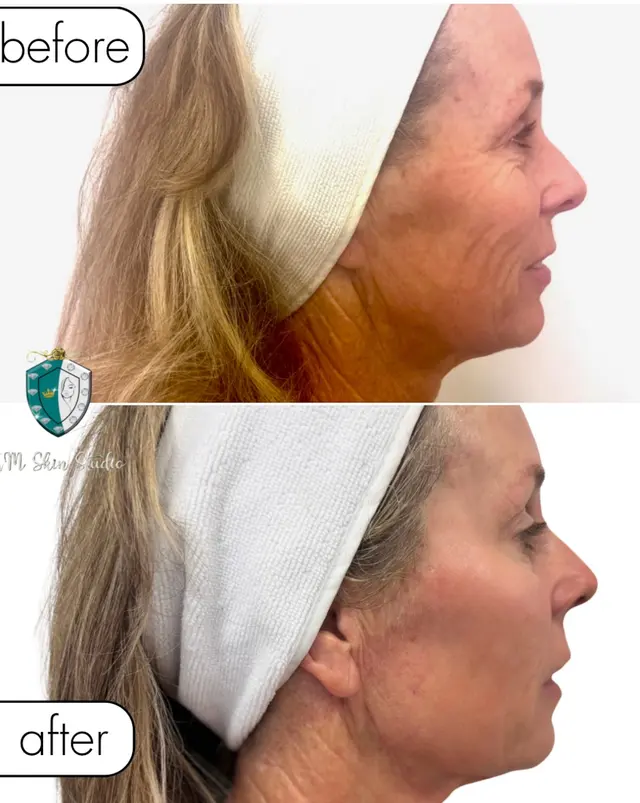 Mediavilla Aesthetics - KM Skin Studio — photo from the business 9
