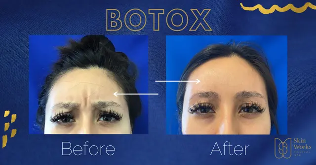 Skin Works Medical Spa | Torrance — photo from the business 4