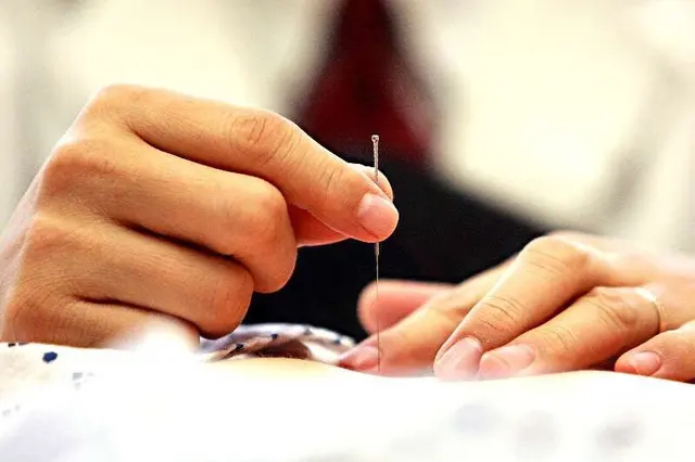 Top Acupuncture Clinic — photo from the business 8
