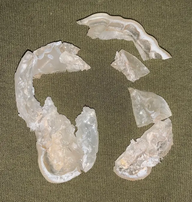 Frederick G. Lehmann, DDS, PA — customer photo 3