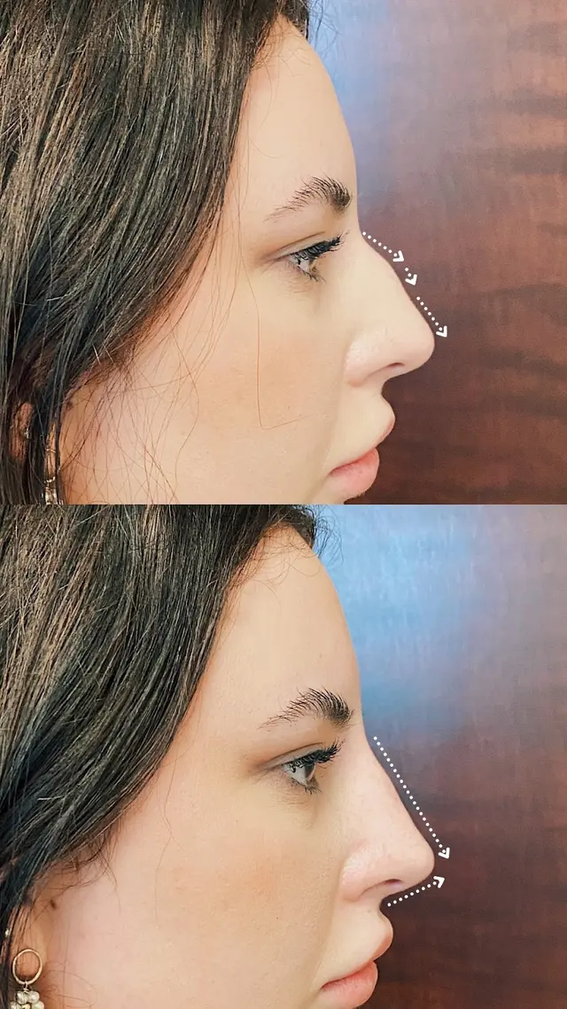 Elase Medical Spa - Ponte Vedra — photo from the business 11