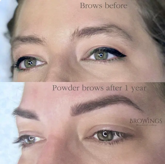 SKN ALLEGIANCE Laser tattoo & Permanent makeup removal — photo from the business 10
